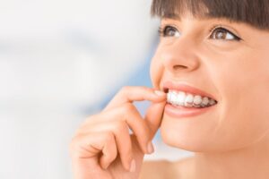 Clear Aligners | Affecting Speech | Grand Dental - Frankfort